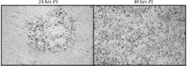 <span class="mw-page-title-main">B virus</span> Species of virus