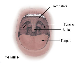 <span class="mw-page-title-main">Tonsil</span> Lymphoid organs in the mouth and throat