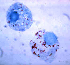 <i>Rickettsia</i> Genus of bacteria