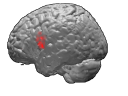 <span class="mw-page-title-main">Brodmann area 44</span> Brain area