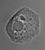 Single amoeboid cell of Dictyostelium, showing the contractile vacuole Contractile vacuole in Dictyostelium.jpg