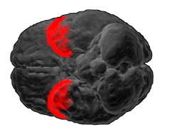 <span class="mw-page-title-main">Brodmann area 38</span> Region of the brains temporal cortex