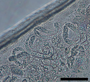 <i>Dirofilaria repens</i> Species of roundworm