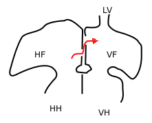 <span class="mw-page-title-main">Foramen secundum</span>