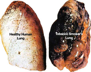 <span class="mw-page-title-main">Smoking cessation</span> Process of discontinuing tobacco smoking