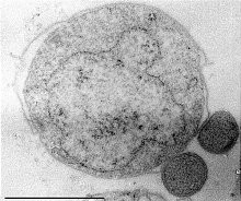 <span class="mw-page-title-main">Eocyte hypothesis</span> Hypothesis in evolutionary biology