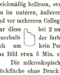 Line drawing by Wilhelm Kuhne of the only "human optogram", an image from the retina of executed prisoner Erhard Gustav Reif. Kuhne Reif human optogram drawing.jpg