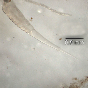 <span class="mw-page-title-main">Pinworm (parasite)</span> Species of worm