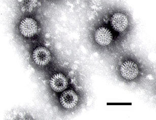 <span class="mw-page-title-main">Double-stranded RNA viruses</span> Type of virus according to Baltimore classification