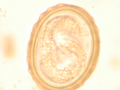 Ձվի մեջ զարգացող Ascaris lumbricoides-ի թրթուրային ձևը