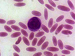 شريحة دم showing elliptocytes