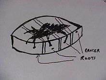 False negative in standard bread loafing histology FalseNegativeBreadLoaf.JPG