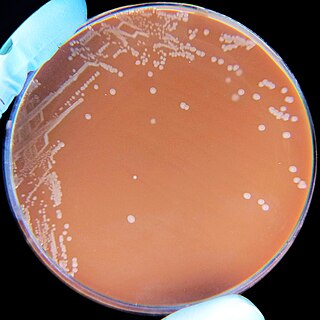 <i>Haemophilus influenzae</i> Species of bacterium