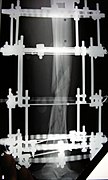 X-ray of the fracture site and the emplaced apparatus, two months post-fracture; perspective 2-2.