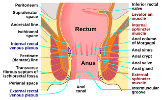 <span class="mw-page-title-main">Anorectal disorder</span> Medical condition