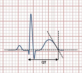 QT interval