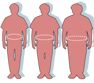 <span class="mw-page-title-main">Obesity</span> Medical condition in which excess body fat harms health