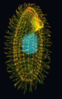 Hymenostome Order of single-celled organisms