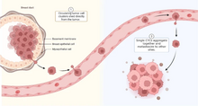 Circulating tumor cells and CTC clusters CTC clusters.webp