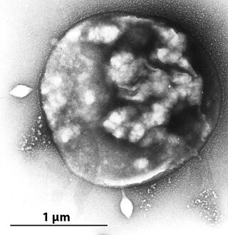 <span class="mw-page-title-main">Archaeal virus</span>