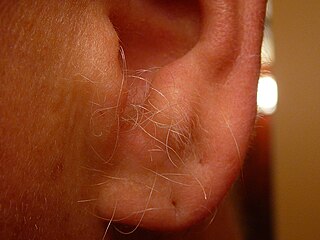 <span class="mw-page-title-main">Ear hair</span> Terminal hair arising from folliculary cartilage inside the external auditory meatus in humans