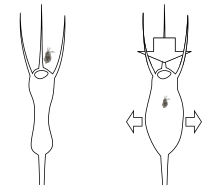 Bladderwort trap mechanism: seen from below, a bladder squeezed by water excretion suddenly swells as its trapdoor is released by an errant Daphnia. The bladder sucks in the nearby water, including the unfortunate animal which triggered the trap. Utricularia trap expansion.svg