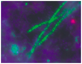 <span class="mw-page-title-main">Acidobacteriaceae</span> Family of bacteria