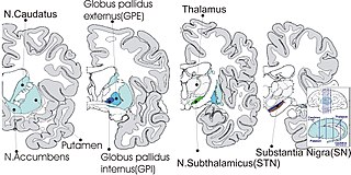 <span class="mw-page-title-main">External globus pallidus</span> Part of the globus pallidus