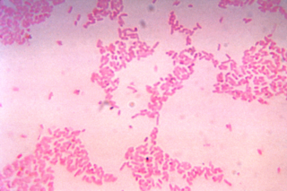 <i>Bacteroides thetaiotaomicron</i> Species of bacterium