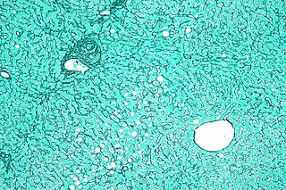 <span class="mw-page-title-main">Reticular fiber</span> Type of connective tissue in animals