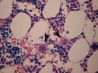 <span class="mw-page-title-main">Megakaryocyte</span> Bone marrow cell which produces platelets