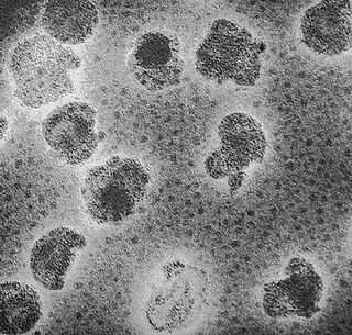 <i>Plasmaviridae</i> Family of viruses