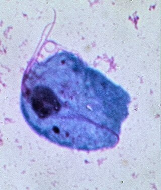 <span class="mw-page-title-main">Trichomoniasis</span> Medical condition