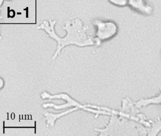 <i>Balamuthia mandrillaris</i> Species of pathogenic Amoebozoa