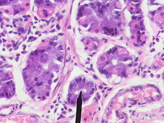 Gastric chief cell