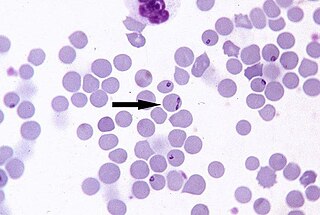 <i>Babesia divergens</i> Species of single-celled organism