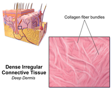 Illustration of dense irregular connective tissue (deep dermis) Blausen 0296 DenseIrregularCT.png