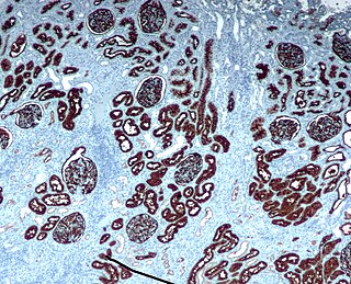 Immunohistochemistry Common application of immunostaining