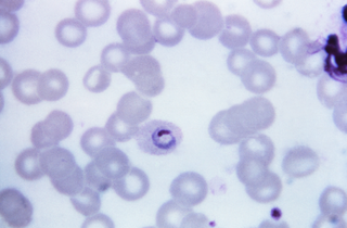 <i>Plasmodium ovale</i> Species of single-celled organism