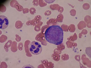 <span class="mw-page-title-main">Promyelocyte</span> Granulocyte precursor cell