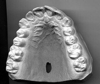 <span class="mw-page-title-main">Dentition</span> Development and arrangement of teeth