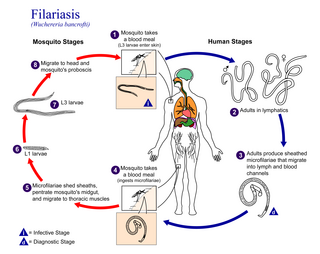 <span class="mw-page-title-main">Filariasis</span> Parasitic disease caused by a family of nematode worms