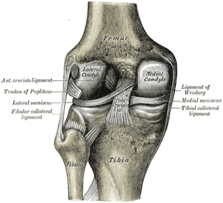 <span class="mw-page-title-main">Spontaneous osteonecrosis of the knee</span> Medical condition