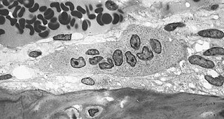 <span class="mw-page-title-main">Bone resorption</span> Medical condition