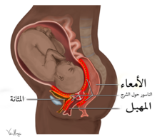 Obstetric Fistula Locations Diagram-ar.png