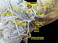 Lateral head anatomy detail.Facial nerve dissection.