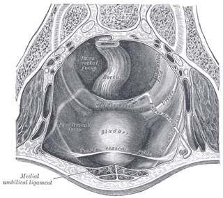 <span class="mw-page-title-main">Medial umbilical ligament</span>