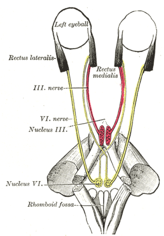 <span class="mw-page-title-main">Sixth nerve palsy</span> Medical condition