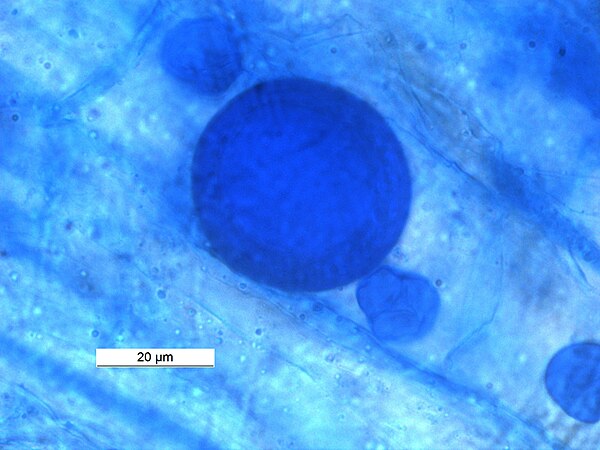 Spore in Vesicular Arbuscular Mycorhizae in root of Macrotyloma uniflorum .