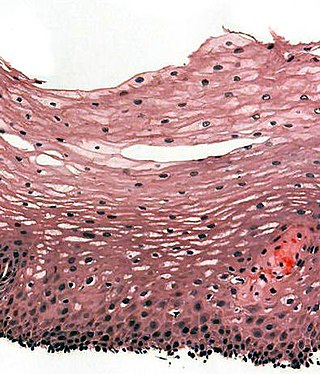 <span class="mw-page-title-main">Stratified squamous epithelium</span> Tissue type